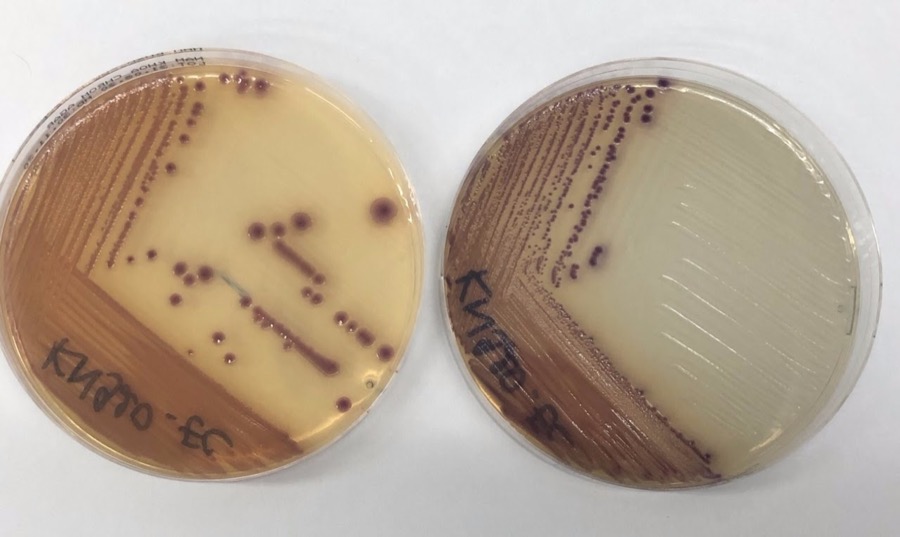 Đĩa chromoagar sàng lọc các vi khuẩn vi khuẩn đường ruột kháng kháng sinh